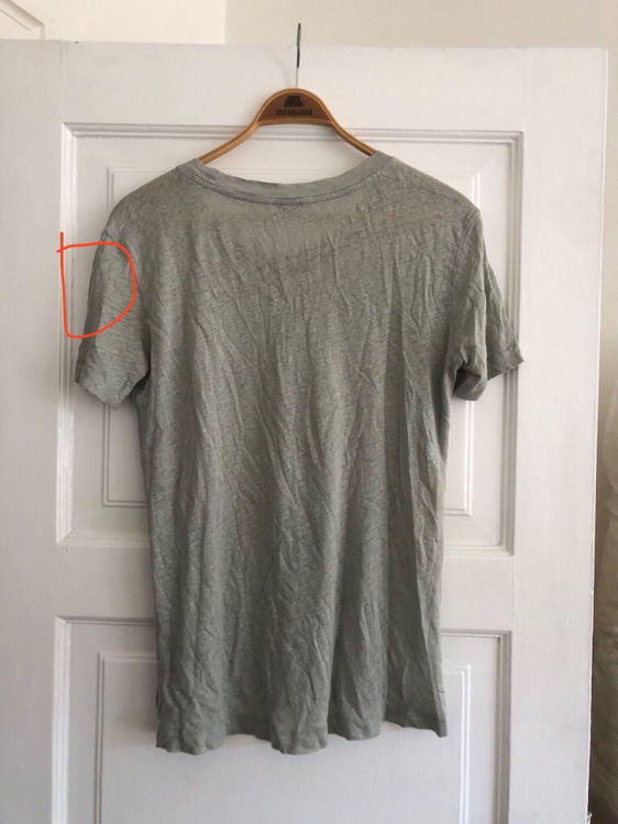 Billede af Acne