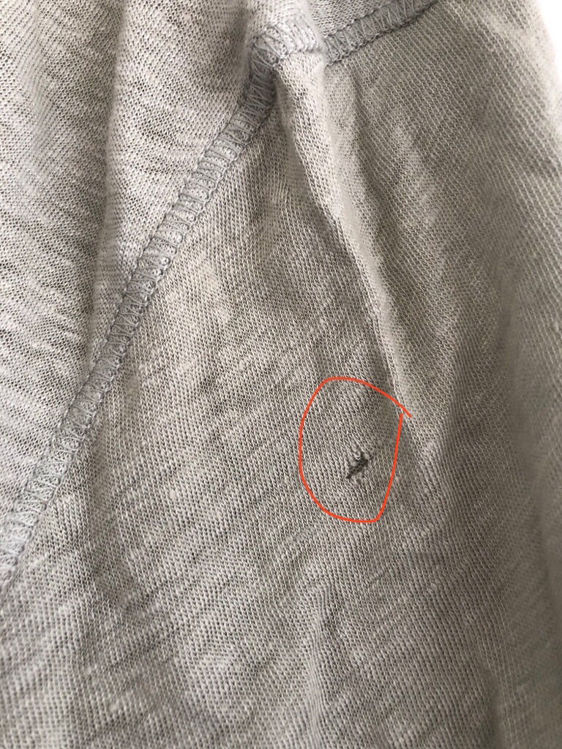 Billede af Acne